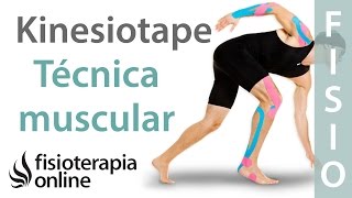 Técnica muscular del Kinesiotaping [upl. by Wil]