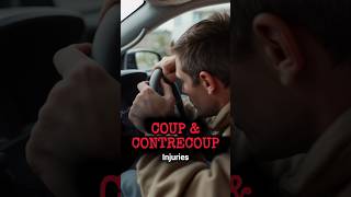 Coup and Contrecoup Head Injury shorts youtubeshorts [upl. by Notsniw]