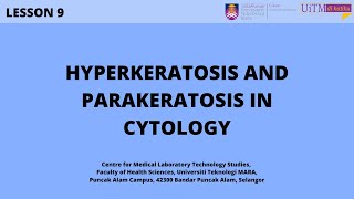 Hyperkeratosis and Parakeratosis in Cytology [upl. by Ardnassac]