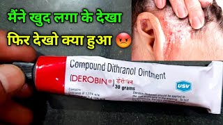 Derobin Cream Uses in Hindi  derobin Cream kis kaam mein ata hai  dad khaj khujli psoriasis [upl. by Greenebaum]