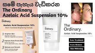 Azelaic Acid Suspension 10 Review  The Ordinary සම පැහැපත් කරන නිශ්පාදන azelaicacid [upl. by Baylor511]