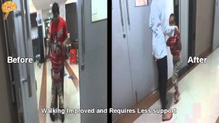 Cerebral Palsy  Africa  Quick Look [upl. by Mosley]