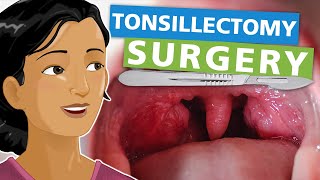 Tonsillectomy Surgery [upl. by Ayekel]