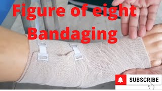 Figure of Eight Bandaging by PC nursing procedure [upl. by Levins528]