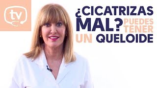 ¿Cicatrizas mal Puedes tener un queloide [upl. by Manya]