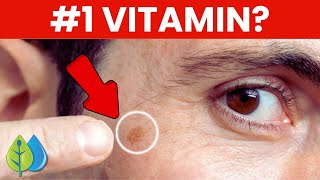 Top 3 Nutrients to Remove Age Spots [upl. by Denman747]