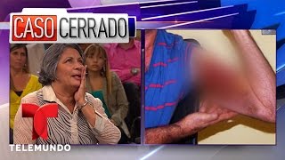 Lo Devoró Una Bacteria Casos Completos  Caso Cerrado  Telemundo [upl. by Schroer671]