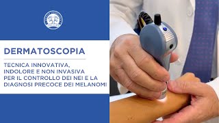 Dermatoscopia  tecnica per il controllo dei nei e la diagnosi precoce dei melanomi [upl. by Eustazio]