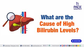 Cause of High Bilirubin Levels  What are the Cause of High Bilirubin Levels  Liverfunctiontest [upl. by Notaek290]