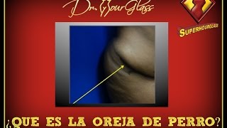 Abdominoplastia orejas de perro por el Dr Curvas Houston Austin Dallas San Antonio [upl. by Maggs316]