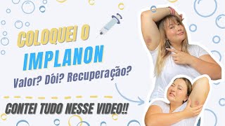 Coloquei o implanon  dói Valor Pós [upl. by Davie]