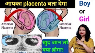 posterior placenta means boy or anterior placenta means girl। प्लासेंटा बता देगा क्या होगा [upl. by Tildi]