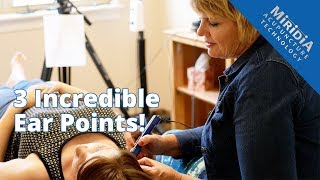 3 Powerful Ear Acupuncture Points that Enhance any Treatment [upl. by Eihcra]