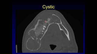 Fibrous Dysplasia and Its Mimics [upl. by Enotna]