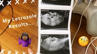 How I Responded To Letrozole Femara [upl. by Teressa139]