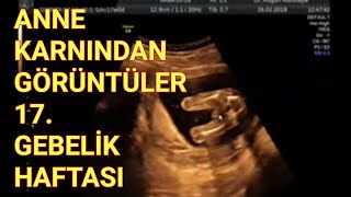 Hafta Hafta Hamilelik  17 gebelik haftasında ultrasonografi görüntüleri  Erkek Bebek [upl. by Marzi]