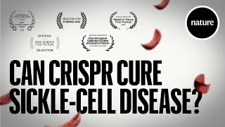 Can CRISPR cure Sicklecell Disease [upl. by Elcin180]