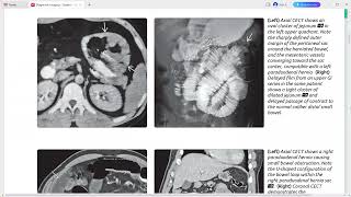 Peritoneum mesentery and abdominal wall imaging [upl. by Odnala]