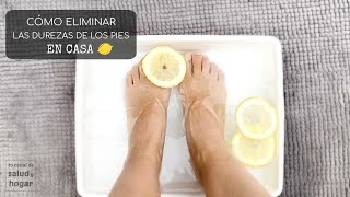 Cómo eliminar las durezas de los pies en casa [upl. by Aira99]