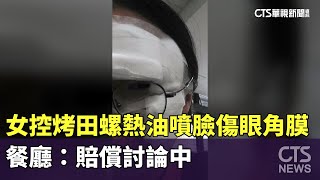 女控烤田螺熱油噴臉傷眼角膜 餐廳：賠償討論中｜華視新聞 20240702 [upl. by Clarisa]