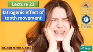 Iatrogenic effect of tooth movement lec23 تقويم الأسنان للمرحلة الرابعة [upl. by Eednahs142]