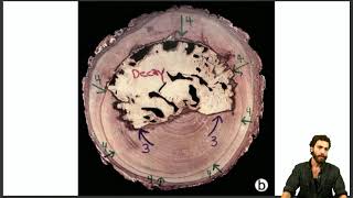 CODIT Compartmentalization of Decay in Trees [upl. by Htelimay]