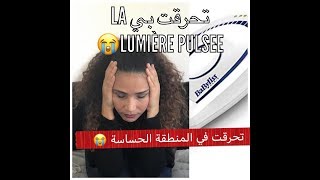 Epilation la lumiére pulsée😥 ازالة الشعر بالضوء [upl. by Halford]