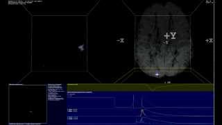 SpikeFun  Single Neuron Stimulation Impact on Simulated Brain Network [upl. by Kennet427]