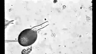 Rop1Ps promote actin cytoskeleton dynamics and control the tip growth of lily pollen tube [upl. by Atteyek]