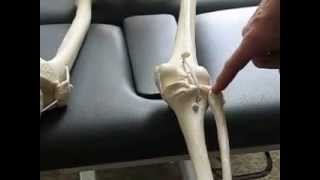 Part 1 Type 2 Cuboid Syndrome  Hesch Method Physical Therapy [upl. by Evaleen]