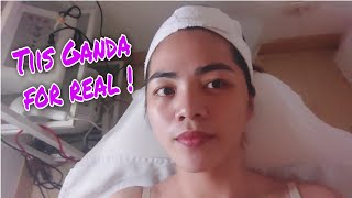 Anti Acne Light Therapy w Glycolic Peel SKINSTATION  Elaine Paja [upl. by Garrik969]