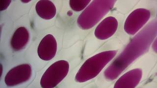 Red onion cell plasmolysis and its reversal [upl. by Eizus655]