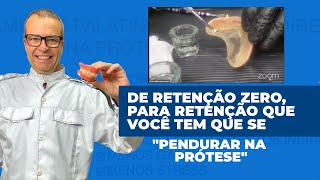 Reembasamento direto em prótese total [upl. by Eedyaj]