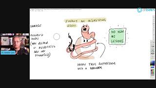 Multiple Sclerosis MS Pathophysiology [upl. by Yrehc530]