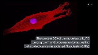 COX2 promotes lung adenocarcinoma progression via exosomal miR1290 [upl. by Hartnett]