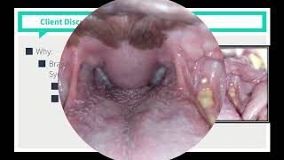 VICE Rounds  Brachycephalic Airway Syndrome See Description For How to Access More Videos [upl. by Demahom139]