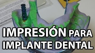 Impresión para IMPLANTE DENTAL Posterior👅 dental [upl. by Cornwell929]