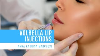 Volbella Lip Injections at Bruno Brown Plastic Surgery [upl. by Grefer960]