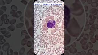 Observe 👀 Basophils Cells Seen In Microscope 🔬 shorts science ytshorts mbbs [upl. by Lada757]