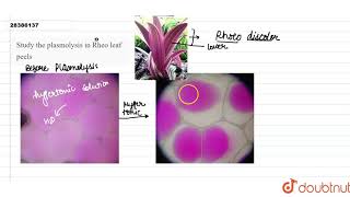 Study the plasmolysis in Rheo leaf peels [upl. by Cirnek]