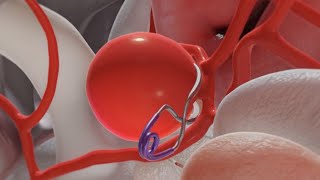 Aneurysm Clipping 3D Animation [upl. by Haakon]