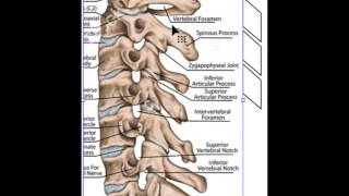 C1C2 posterior fixation Part 1 [upl. by Erret92]