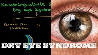 Dry Eye Syndrome  keratoconjunctivitis sicca  Part 1 [upl. by Gwenn448]