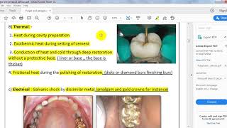 ENDODONTICS ll pulpal and periapical pathosis [upl. by Utter88]