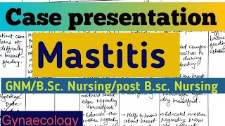 case presentation of mastitis mastitis case presentation casepresentation [upl. by Jerry943]