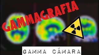 La Gammagrafia [upl. by Lledrev]