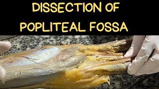 DISSECTION OF POPLITEAL FOSSA [upl. by Blakelee]