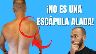 ⚠️¿Tienes escápula ALADA o DISCINESIA escapular CÓMO distinguirlas y su TRATAMIENTO✅ [upl. by Publias]