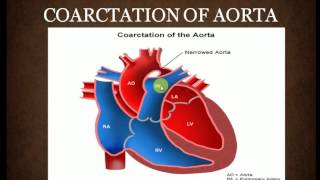 CONGENITAL HEART DISEASE  Part 1  PAEDIATRICS LECTURES  INTRODUCTION [upl. by Sregor370]