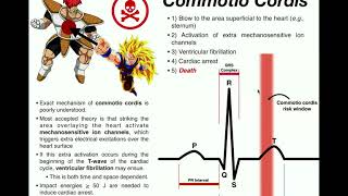 The Mechanism of Commotio Cordis [upl. by Nairam]